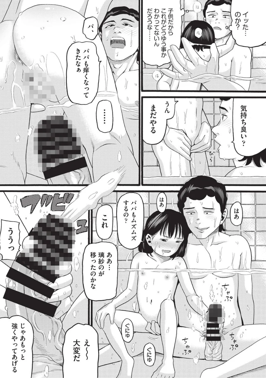 股間がかゆくてたまらない（単話） 試し読み 5ページ